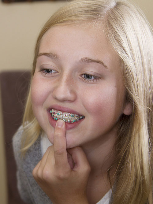 orthodontic faqs